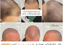 Bild zu Zahide Keskin-Topcu, Keskin Haarinstitut