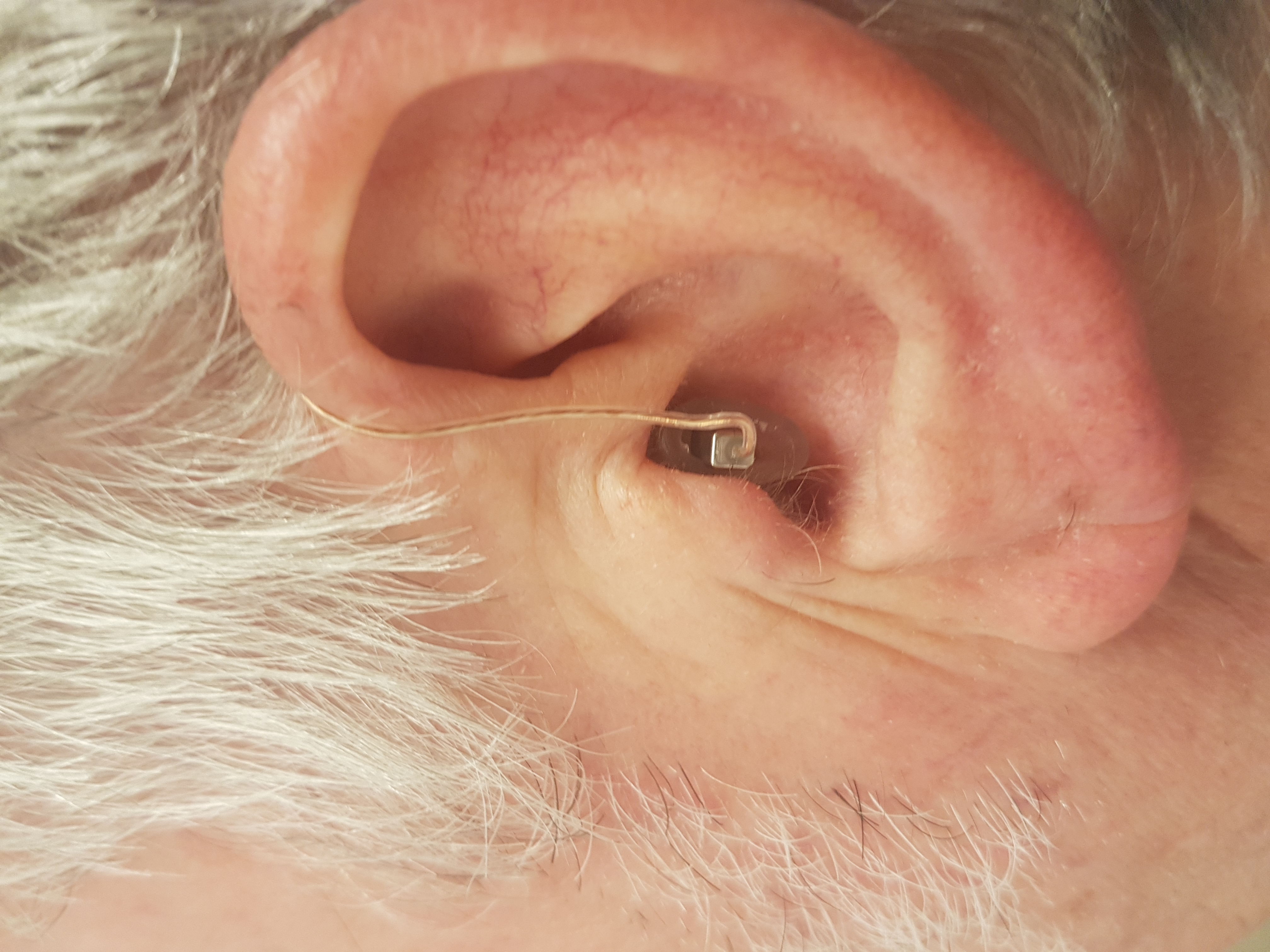 Verschiedene Hörhilfen würden mir gezeigt: Hier sieht man ein kleines Hinter-dem-Ohr Hörgerät.