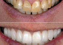 Bild zu Zahnarztpraxis PearlDent