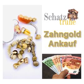 Zahngold Ankauf