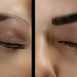 Microblading ist eine spezielle Pigmentiertechnik, bei der die Kunden eine täuschend echte Härchenzeichnung an den Augenbrauen erhalten, welche von natürlichen Augenbrauen kaum zu unterscheiden ist. Diese Methode ist ideal für alle, die die Optik ihrer Augenbrauen verbessern möchten. Die Ergebnisse wirken sehr natürlich. Microblading ist geeignet für alle Menschen, die mit der Form und Dichte ihrer Augenbrauen unzufrieden sind, ebenso Menschen, die durch Krankheit, Narben u. Ä. Härchen verloren 