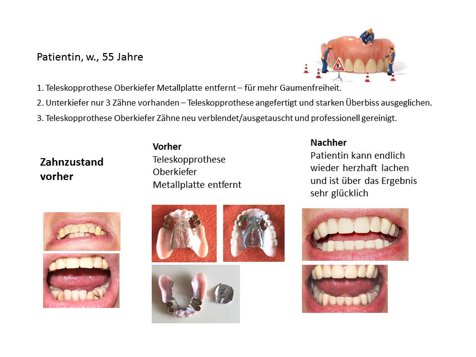 Zahnzustand vor und nach der Behandlung