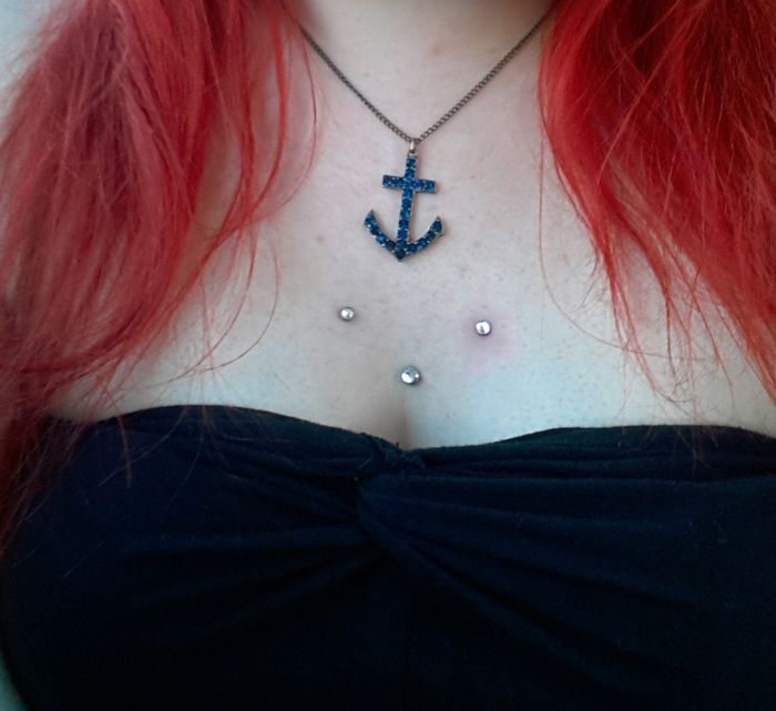 Dermal Anchors by Mella (mehrere Jahre getragen, mussten wegen einer OP raus)