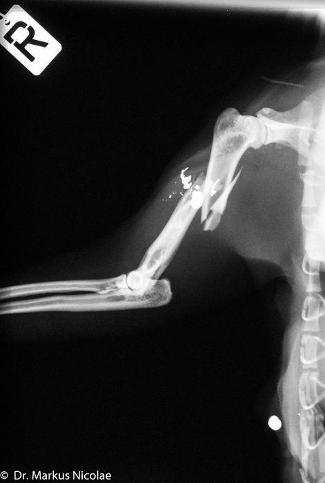 Röntgenbild Schussverletzung