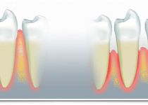 Bild zu Zahnarztpraxis und Zahntechniklabor Zahnarzt Dr. med. dent. Antonis Alexakis