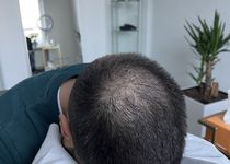 Bild zu Acurahair / Haarpigmentierung Frankfurt