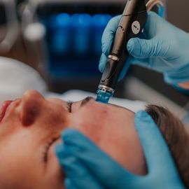 Hydrafacial-Behandlung Mann im Kosmetikstudio von Margarita M. Cosmetics in Remscheid